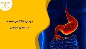 تصویر 3 بعدی ریفلاکس معده که با عسل قابل درمان است