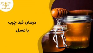 درمان کبد چرب با عسل